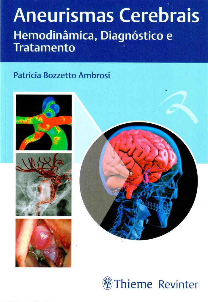 Aneurismas Cerebrais Hemodinamica Diagnostico E Tratamento