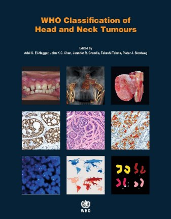 Who Classification Of Head And Neck Tumours