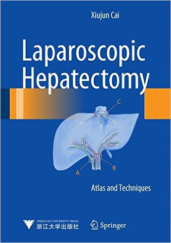 Laparoscopic Hepatectomy