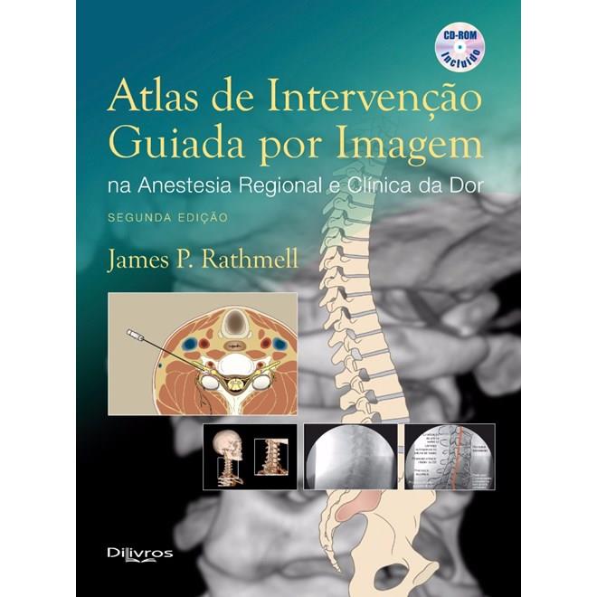 Atlas De Intervenção Guiada Por Imagem Na Anestesia Regional E Clínica Da Dor