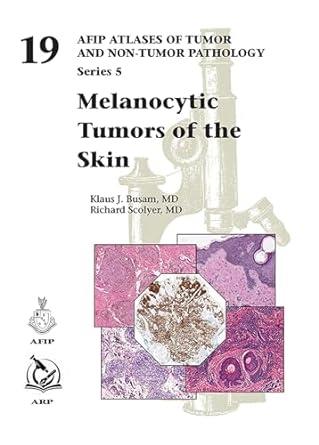 Melanocytic Tumors Of The Skin  (5f19)