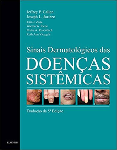 Sinais Dermatologicos Das Doencas Sistemicas