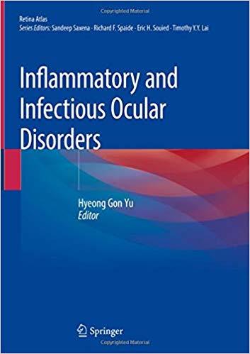 Inflammatory And Infectious Ocular Disorders
