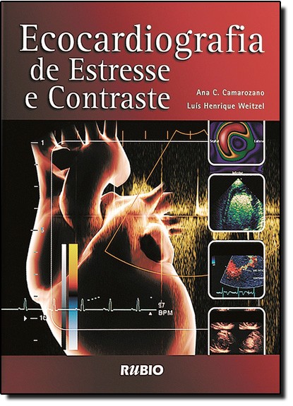 Ecocardiografia De Estresse E Contraste C/ Cd-rom