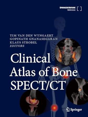 Clinical Atlas Of Bone Spect/ Ct