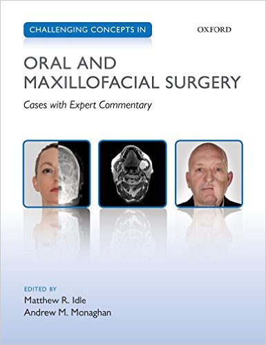 Challenging Concepts In Oral And Maxillofacial Surgery