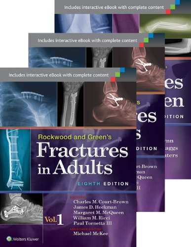 Rockwood And Greens Fractures In Adults And Children (package) 3 Vols.