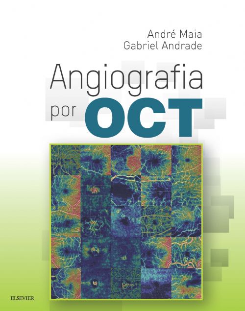 Angiografia Por Oct
