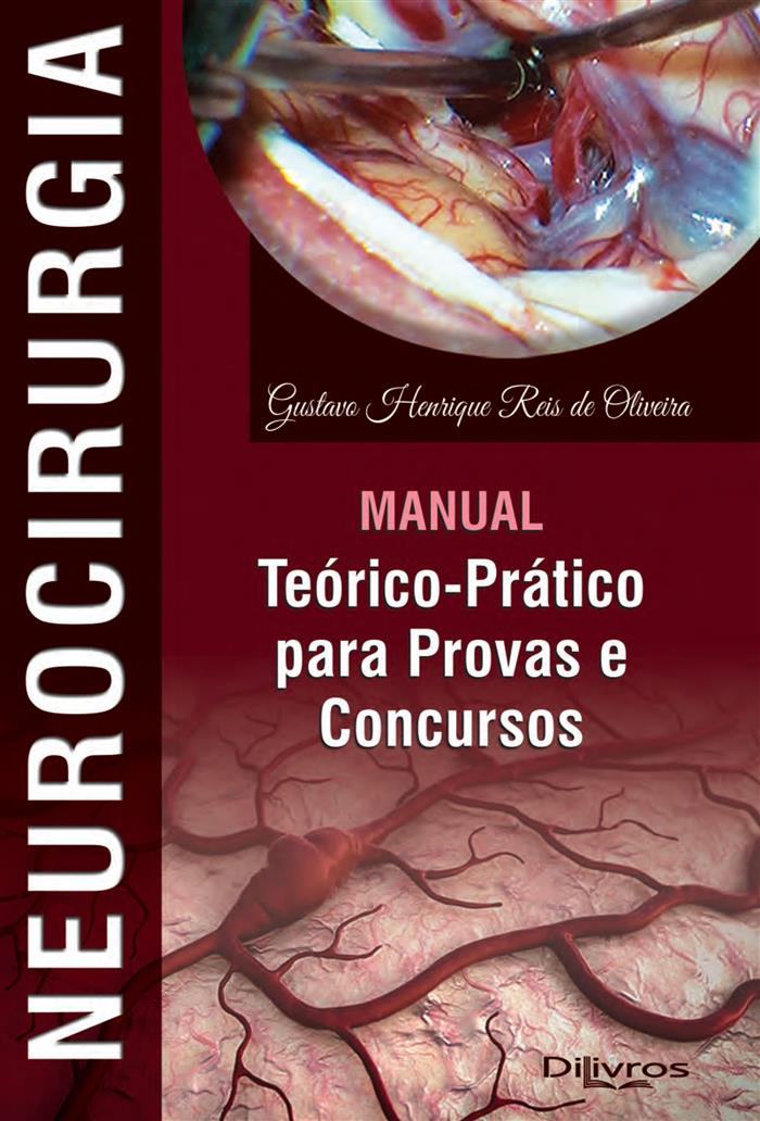 Neurocirurgia Manual Teorico Pratico Para Provas E Concursos