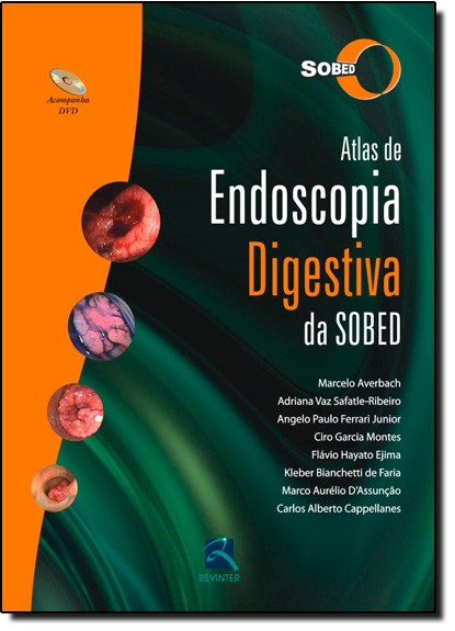 Atlas De Endoscopia Digestiva Da Sobed