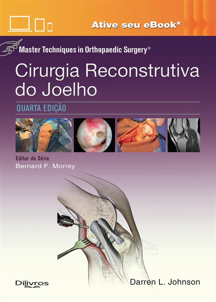 Cirurgia Reconstrutiva Do Joelho Master Techniques In Orthopaedic Surgery