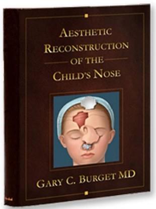 Aesthetic Reconstruction Of The Childs Nose