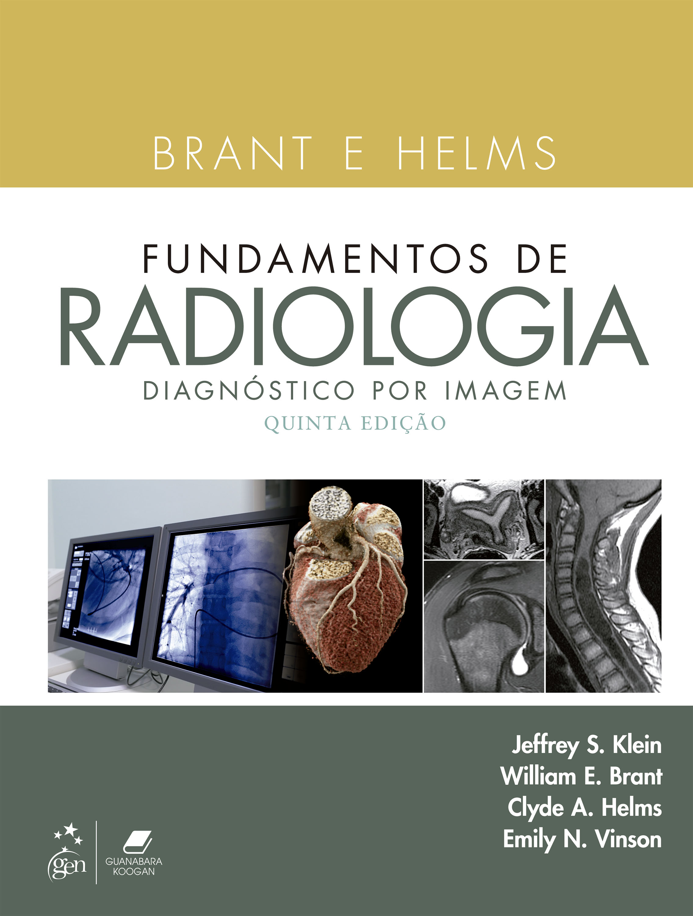 Brant E Helms Fundamentos De Radiologia: Diagnóstico Por Imagem