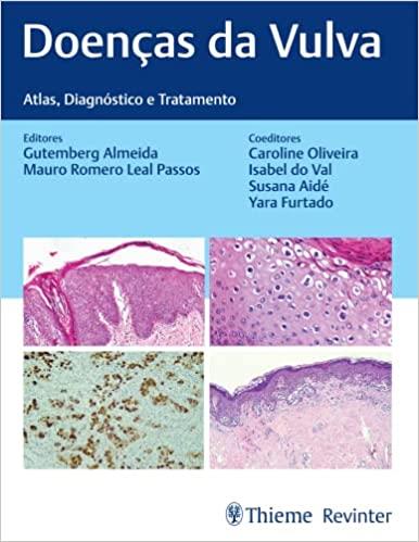 Doenças Da Vulva: Atlas, Diagnóstico E Tratamento