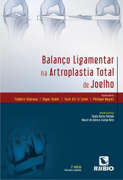 Balanco Ligamentar Na Artroplastia Total De Joelho