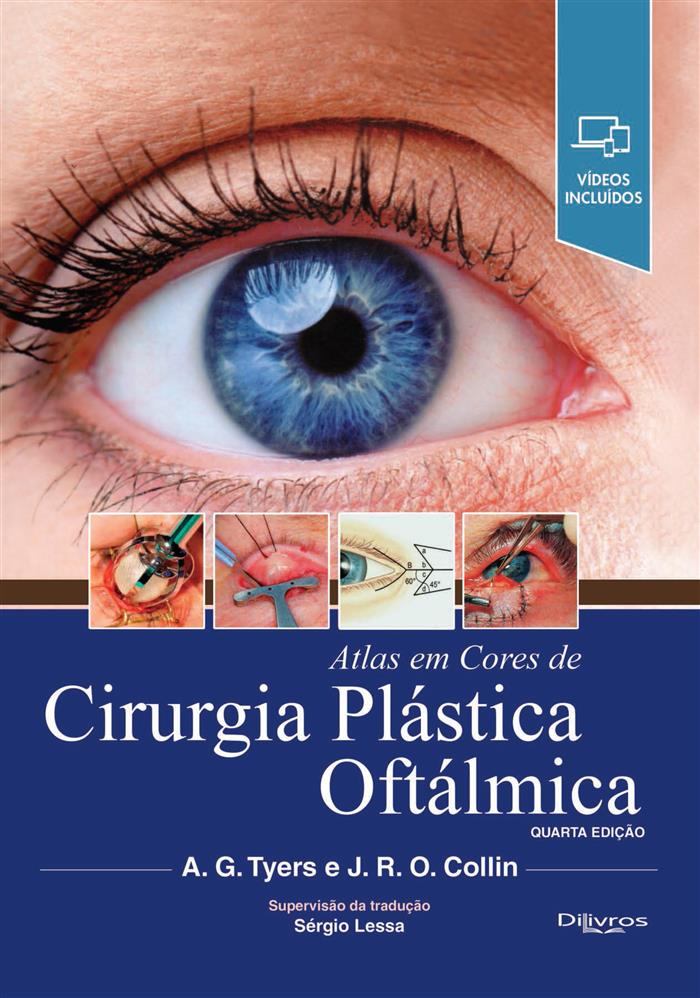 Atlas Em Cores De Cirurgia Plastica Oftalmica