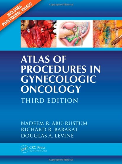 Atlas Of Procedures In Gynecologic Oncology