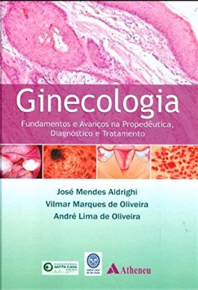 Ginecologia - Fundamentos E Avanços Na Propedêutica, Diagnóstico E Tratamento
