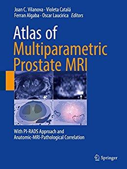 Atlas Of Multiparametric Prostate Mri