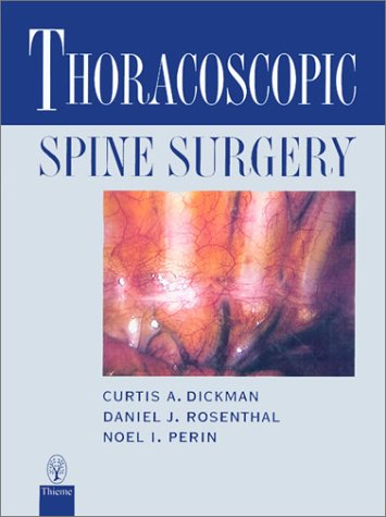 Thoracoscopic Spine Surgery