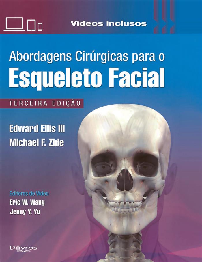 Abordagens Cirurgicas Para O Esqueleto Facial