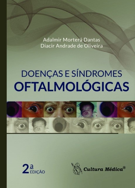 Doencas E Sindromes Oftalmologicas