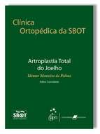 Clínica Ortopédica Da Sbot - Artroplastia Total Do Joelho