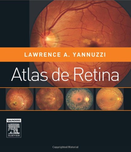 Atlas De Retina