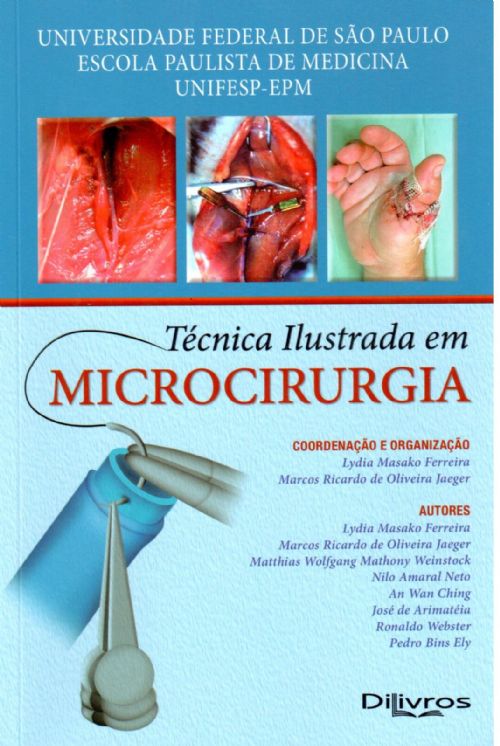 Tecnica Ilustrada Em Microcirurgia