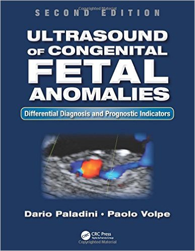 Ultrasound Of Congenital Fetal Anomalies