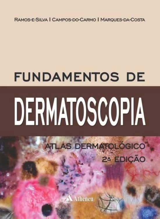 Fundamentos De Dermatoscopia Atlas Dermatologico