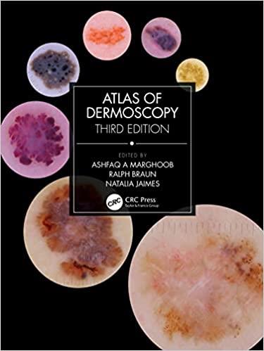 Atlas Of Dermoscopy
