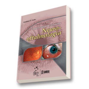 Diagnóstico Rápido Em Oftalmologia Neuro-oftalmologia