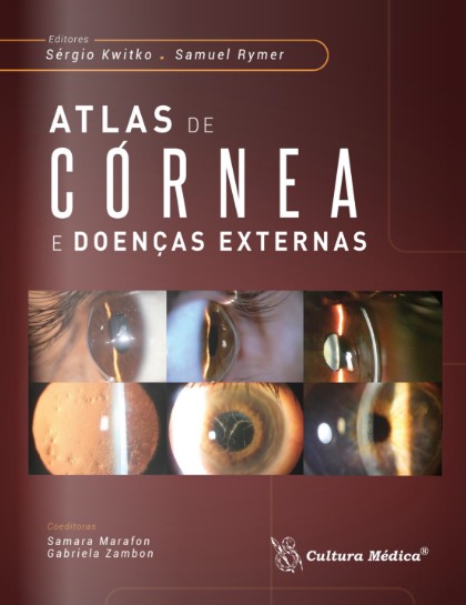 Atlas De Cornea E Doencas Externas