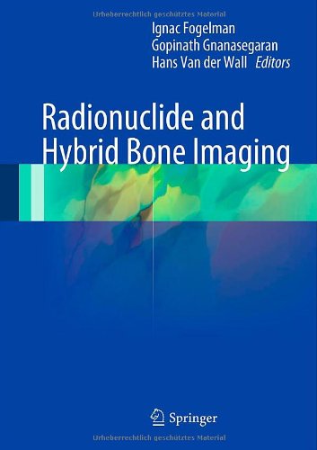 Radionuclide And Hybrid Bone Imaging